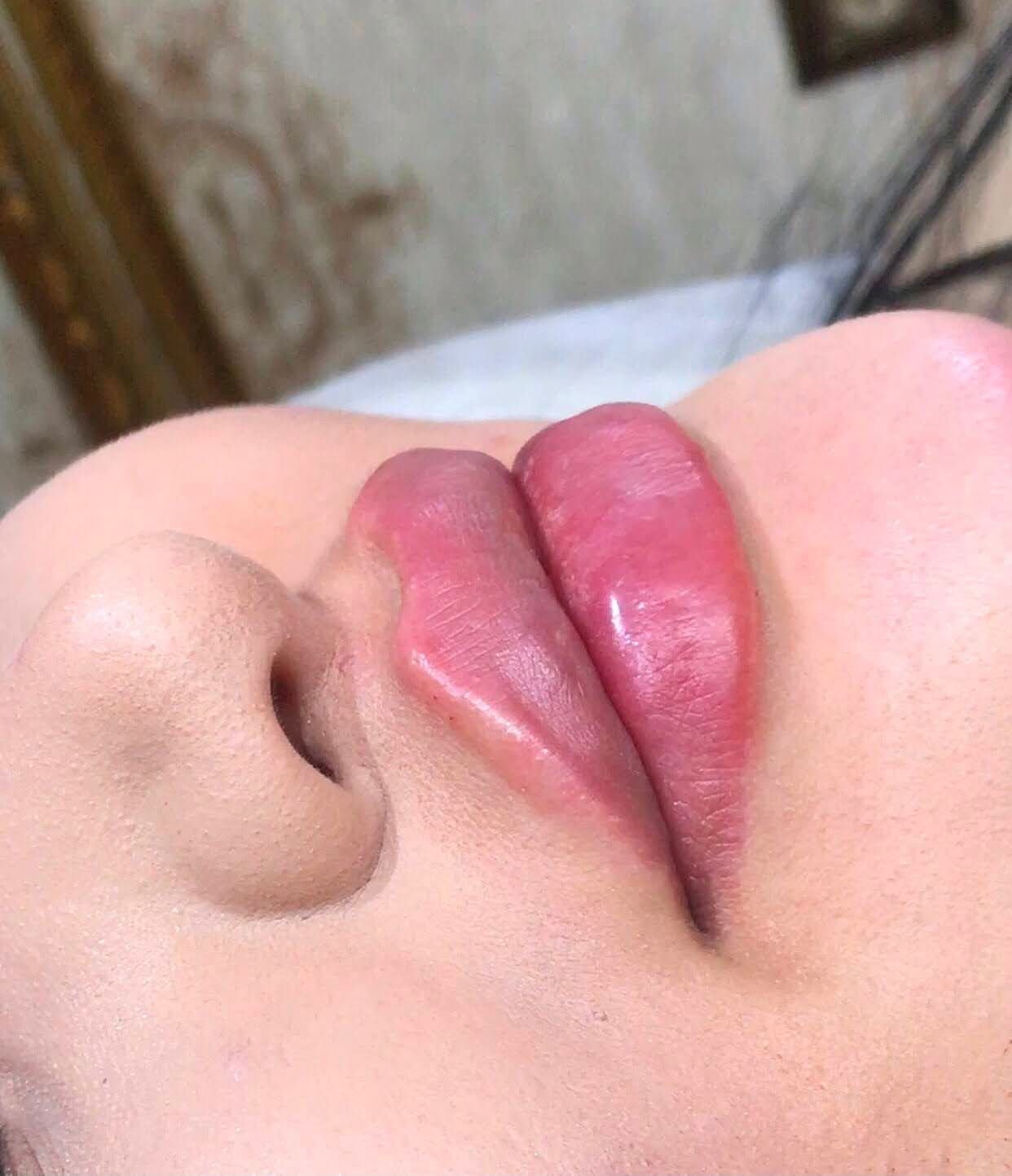 Permanent Lips Result