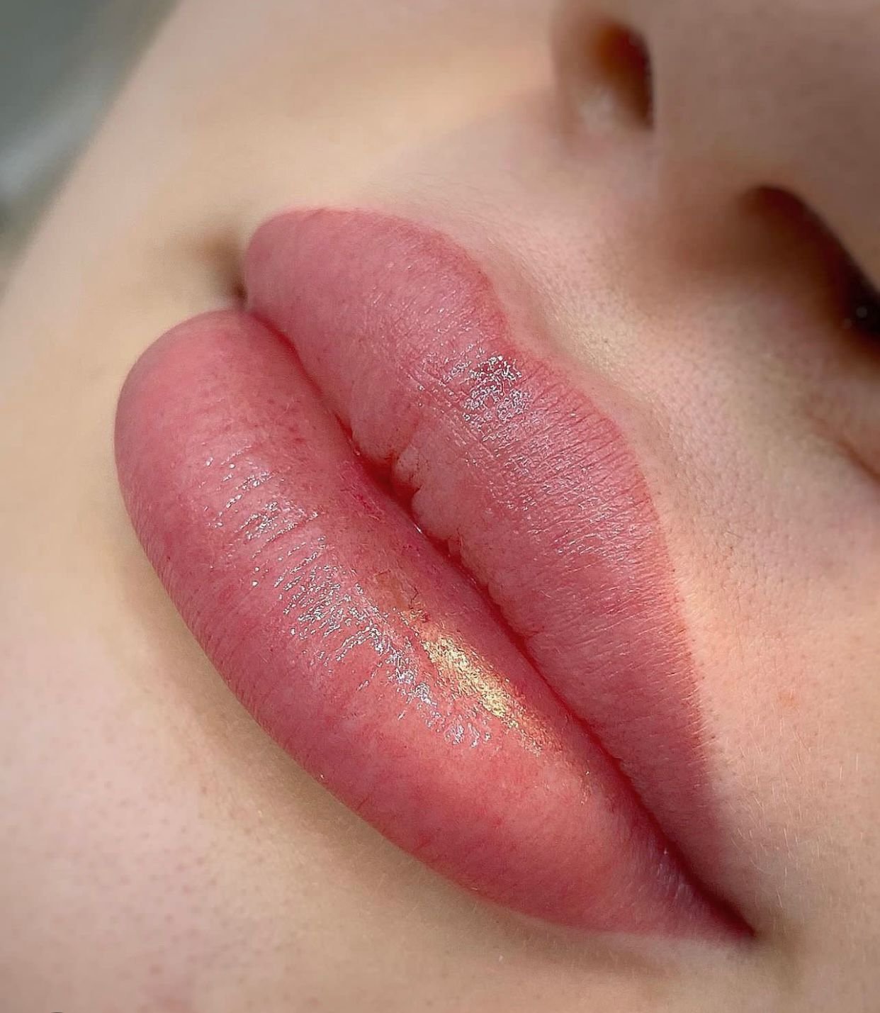 Lip Blush Result
